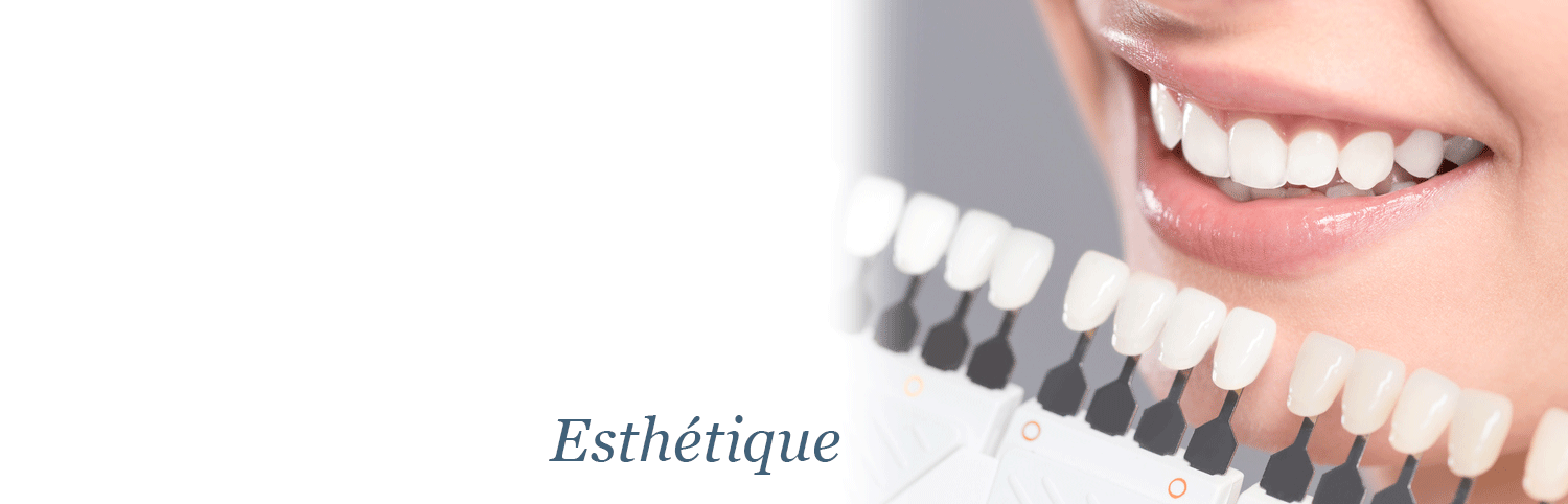 //selarl-palladio-chirurgiens-dentistes.fr/wp-content/uploads/2020/12/cartouche_esthetique.png